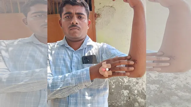 वाराणसी में अज्ञात कार सवारों ने युवक को मारी गोली, पुल‍ि‍स ने मामला दर्ज क‍िया
