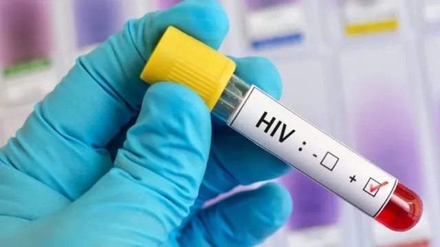 छत्तीसगढ़ की जेल में मिले HIV संक्रमित चार कैदी, कैसे पहुंचा संक्रमण?