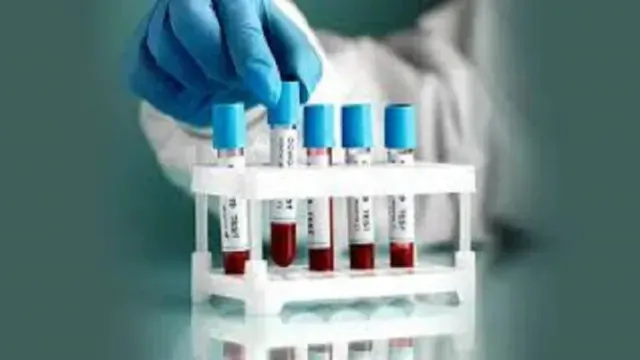 चाईबासा HIV संक्रमित रक्तकांड: निचली अदालत से झटका, लेकिन हाई कोर्ट से दो डॉक्टरों को मिली अग्रिम जमानत