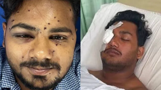 ‘हमेशा के लिए जा सकती है आंखों की रोशनी’, जंतर-मंतर हिंसा के बाद पैलेट गन के खतरों पर क्या बोले एक्सपर्ट्स?