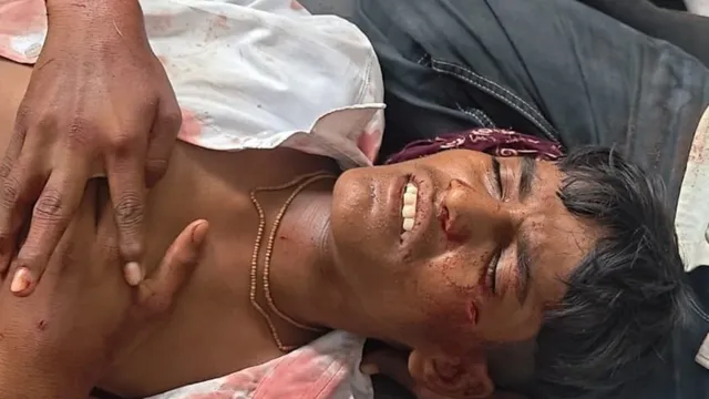 अमरोहा में 15 साल के साले पर चाकू से हमला, ‘चाबी लेनी है’ कहकर स्कूल से ले गया जीजा